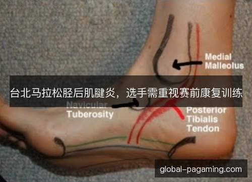 台北马拉松胫后肌腱炎，选手需重视赛前康复训练